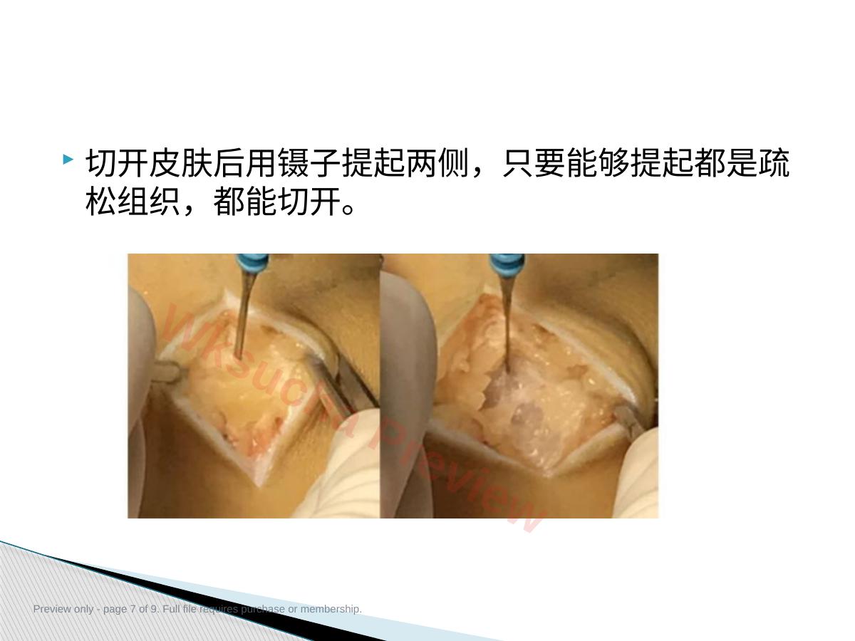 预览第 7 页