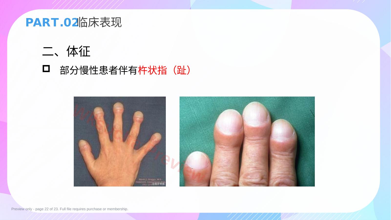 预览第 22 页