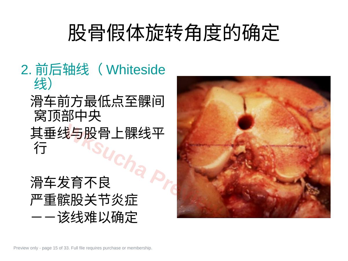 预览第 15 页