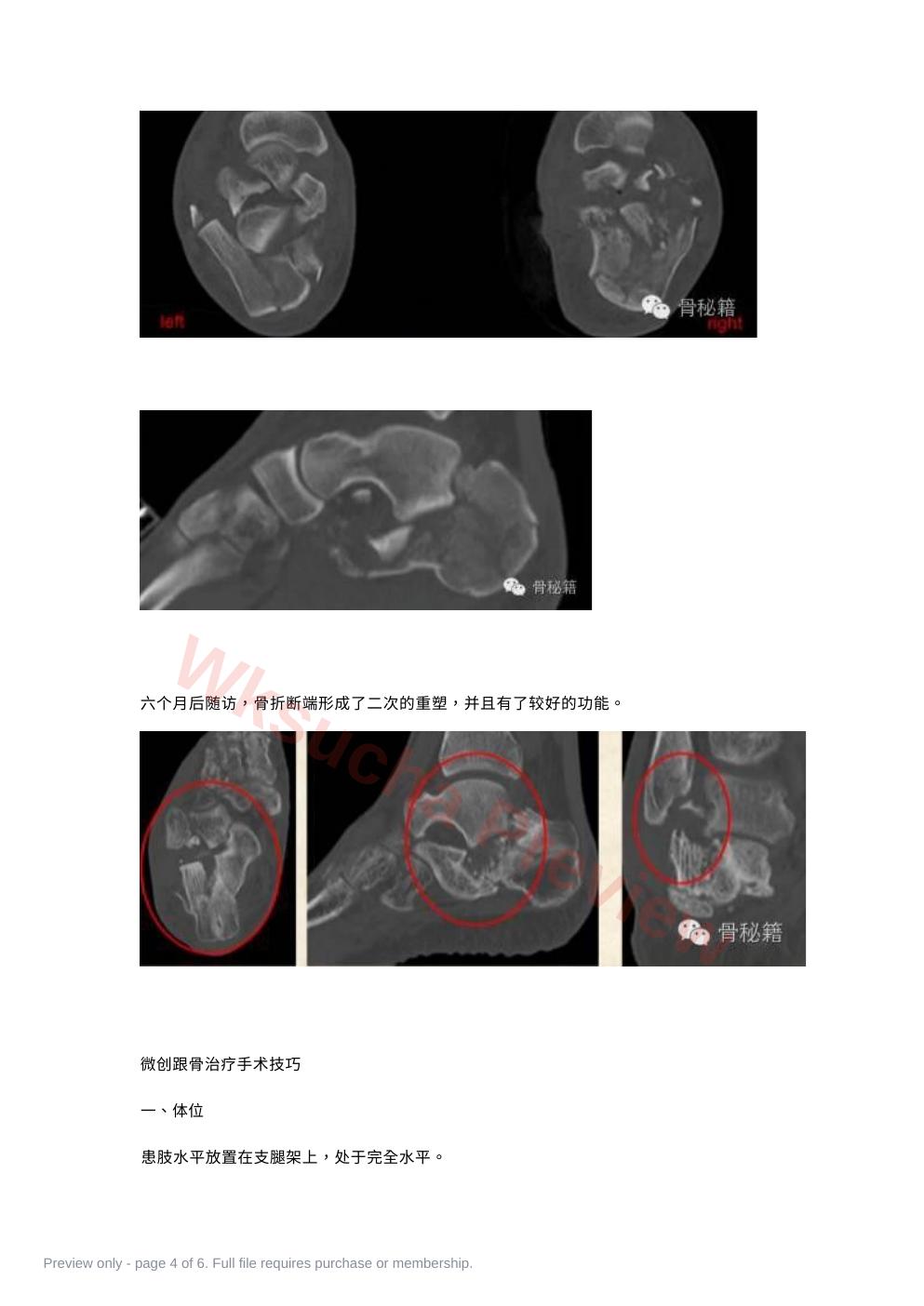 预览第 4 页