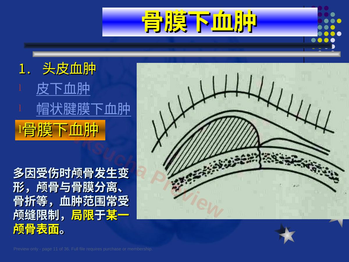 预览第 11 页