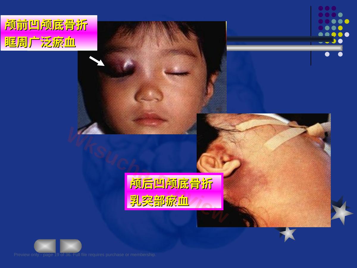 预览第 19 页
