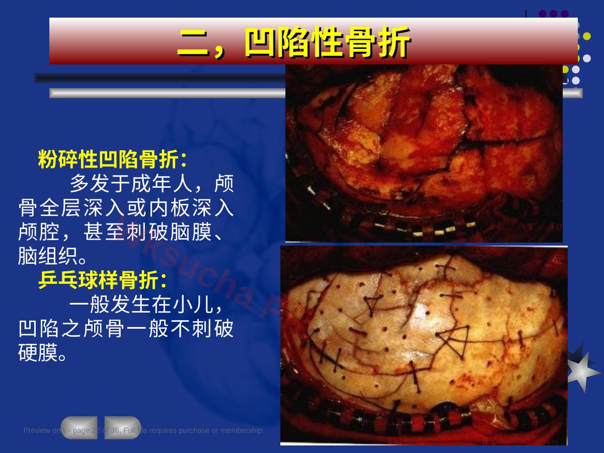 预览第 22 页