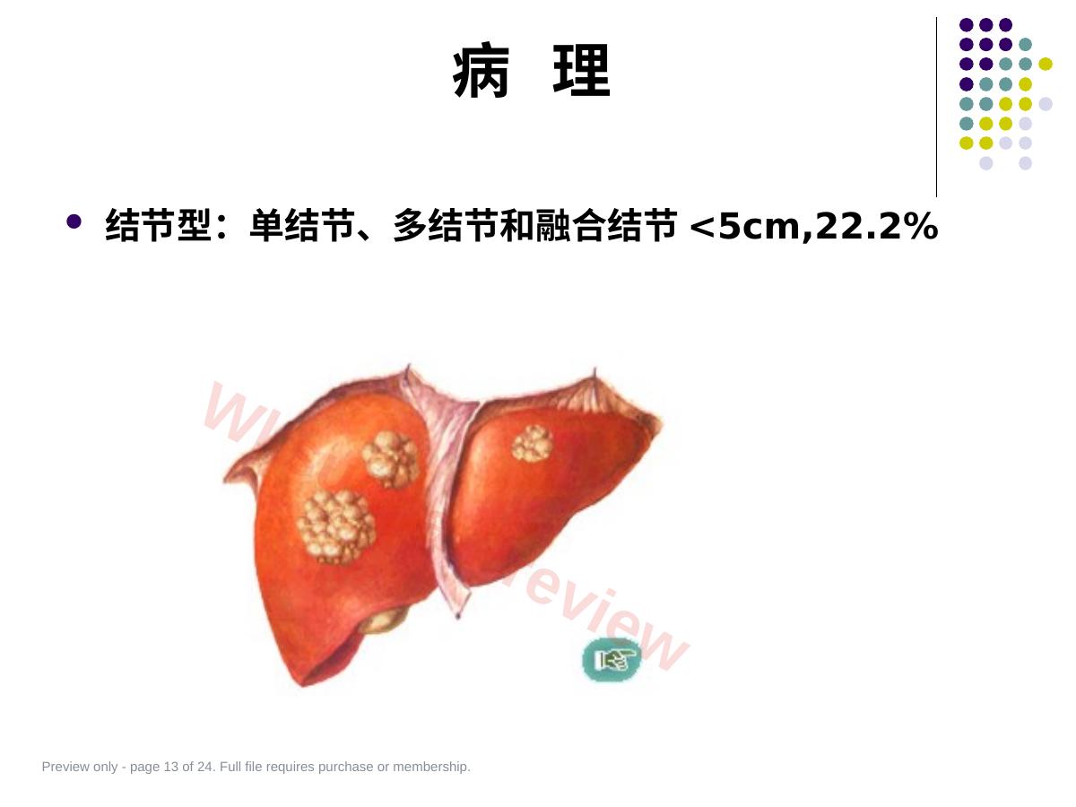 预览第 13 页