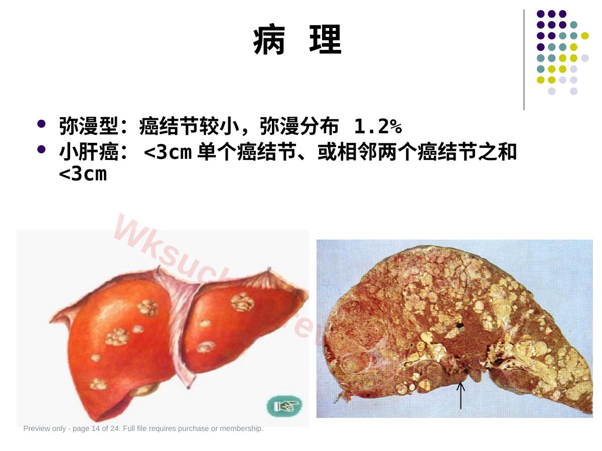 预览第 14 页