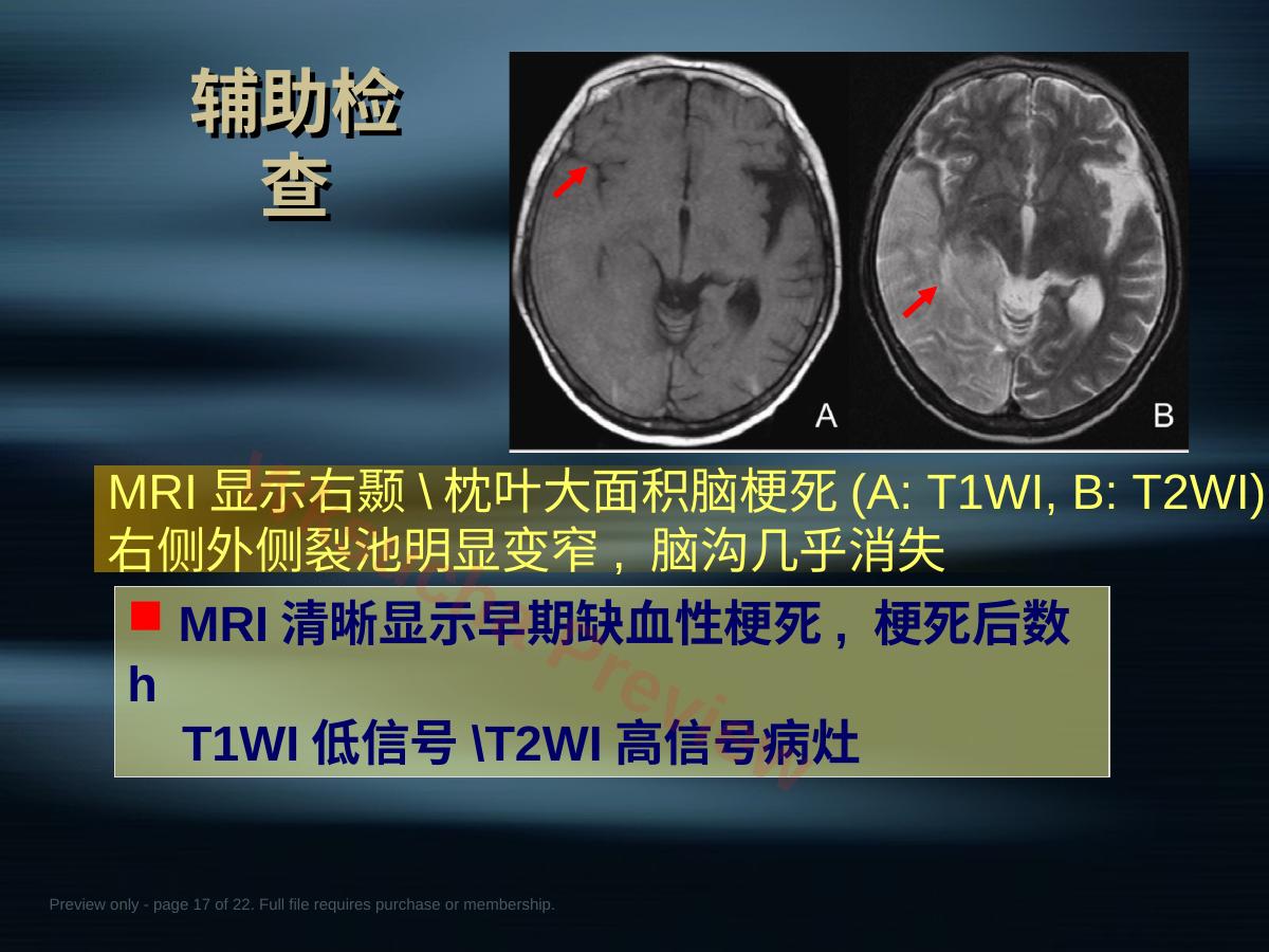 预览第 17 页
