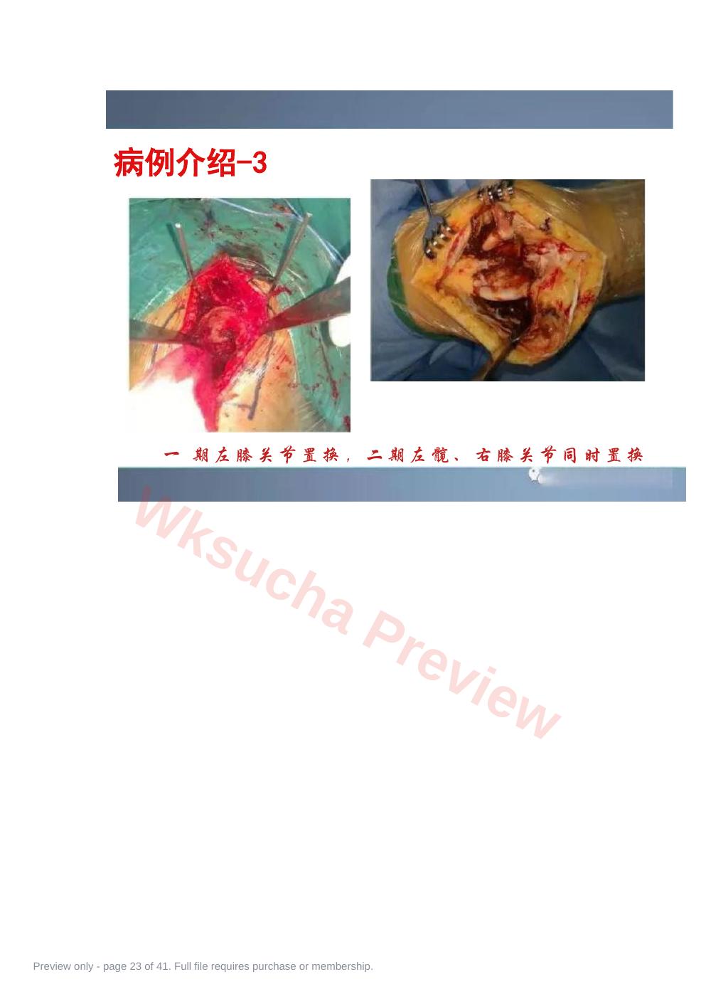 预览第 23 页