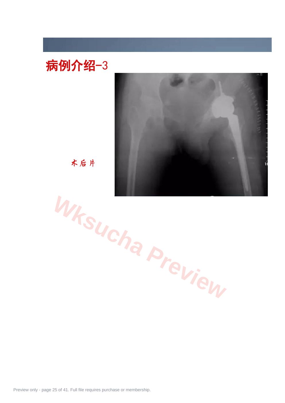 预览第 25 页