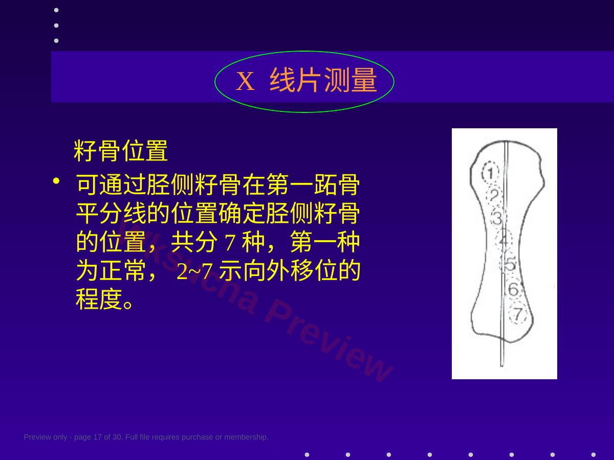 预览第 17 页