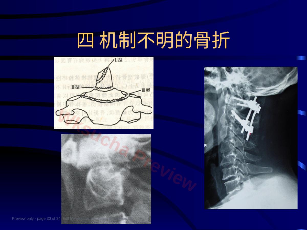 预览第 30 页