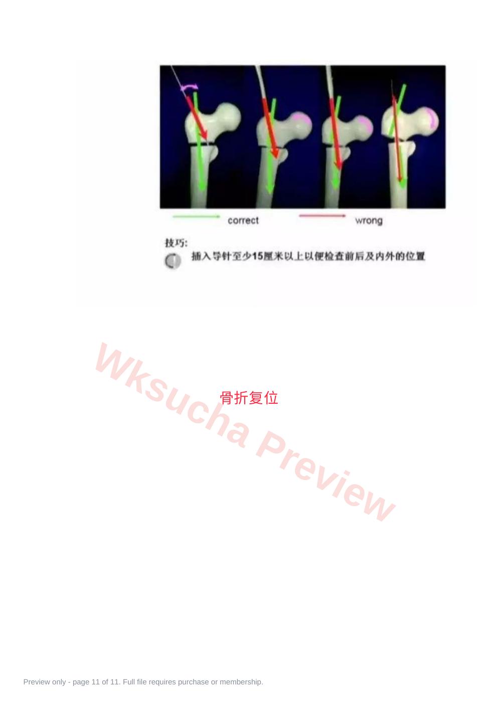 预览第 11 页