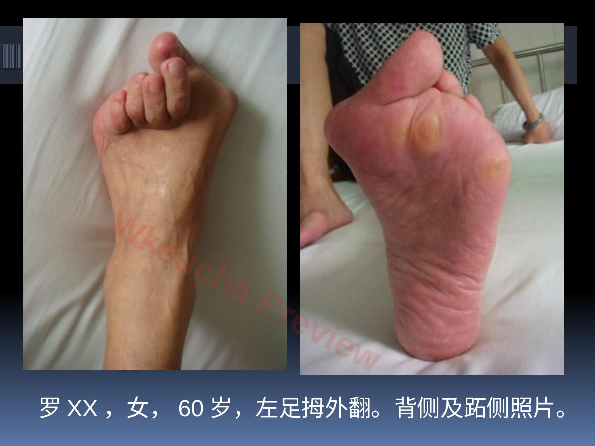 预览第 5 页