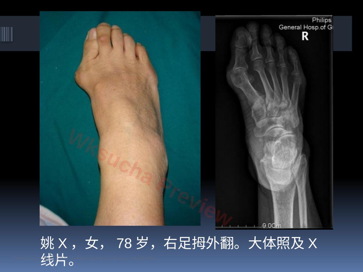 预览第 6 页
