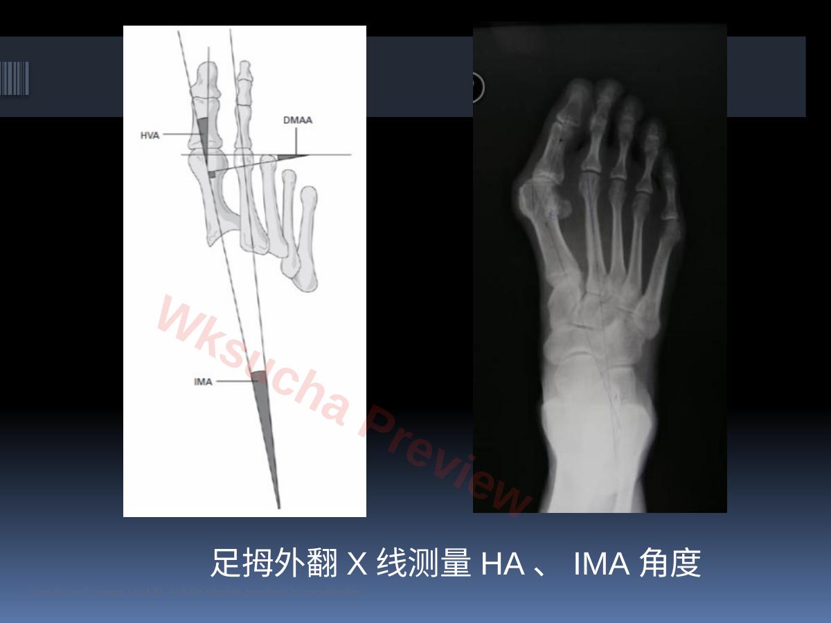 预览第 14 页