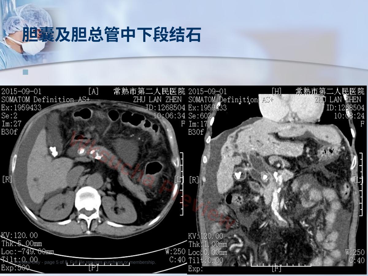 预览第 5 页