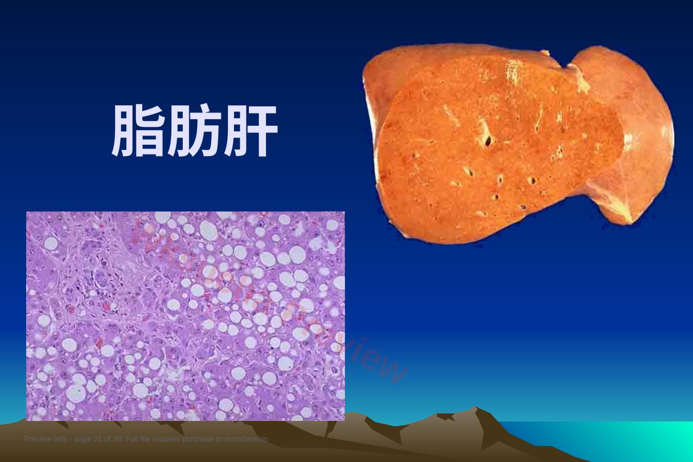 预览第 21 页