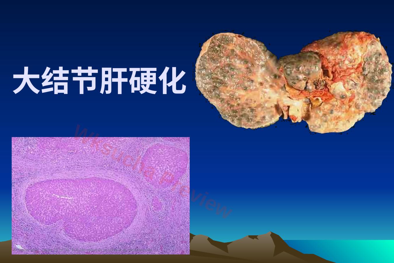预览第 22 页