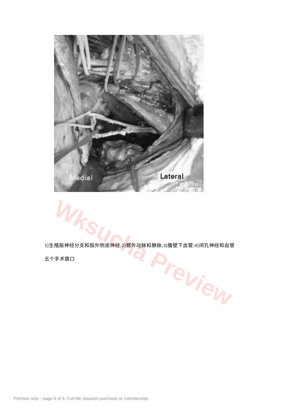 预览第 6 页