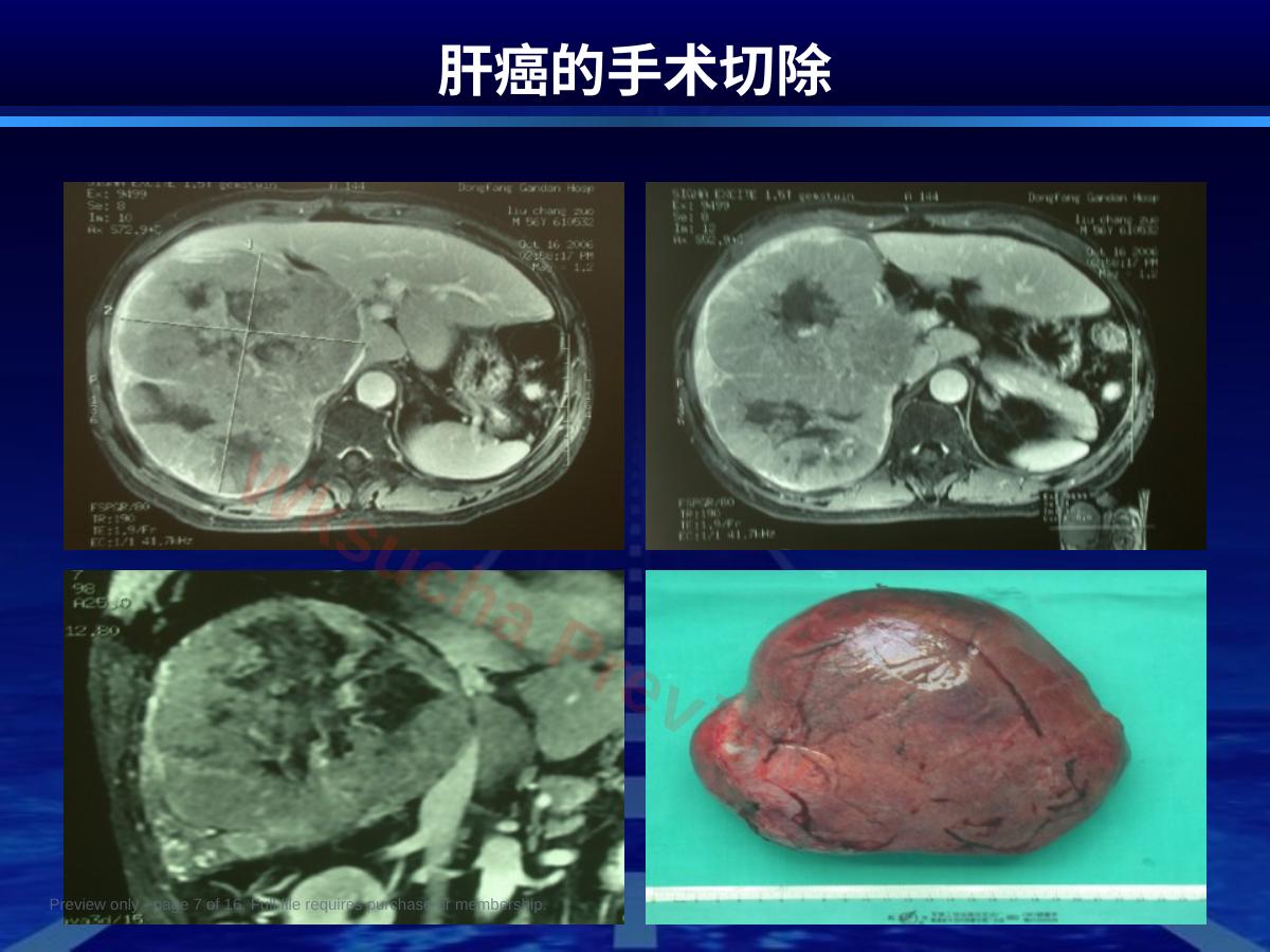 预览第 7 页