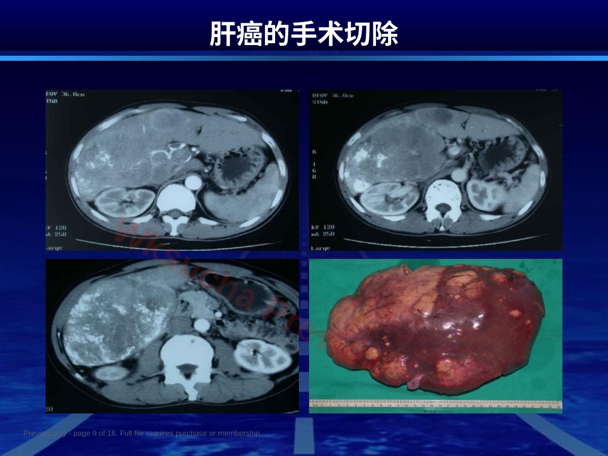 预览第 9 页