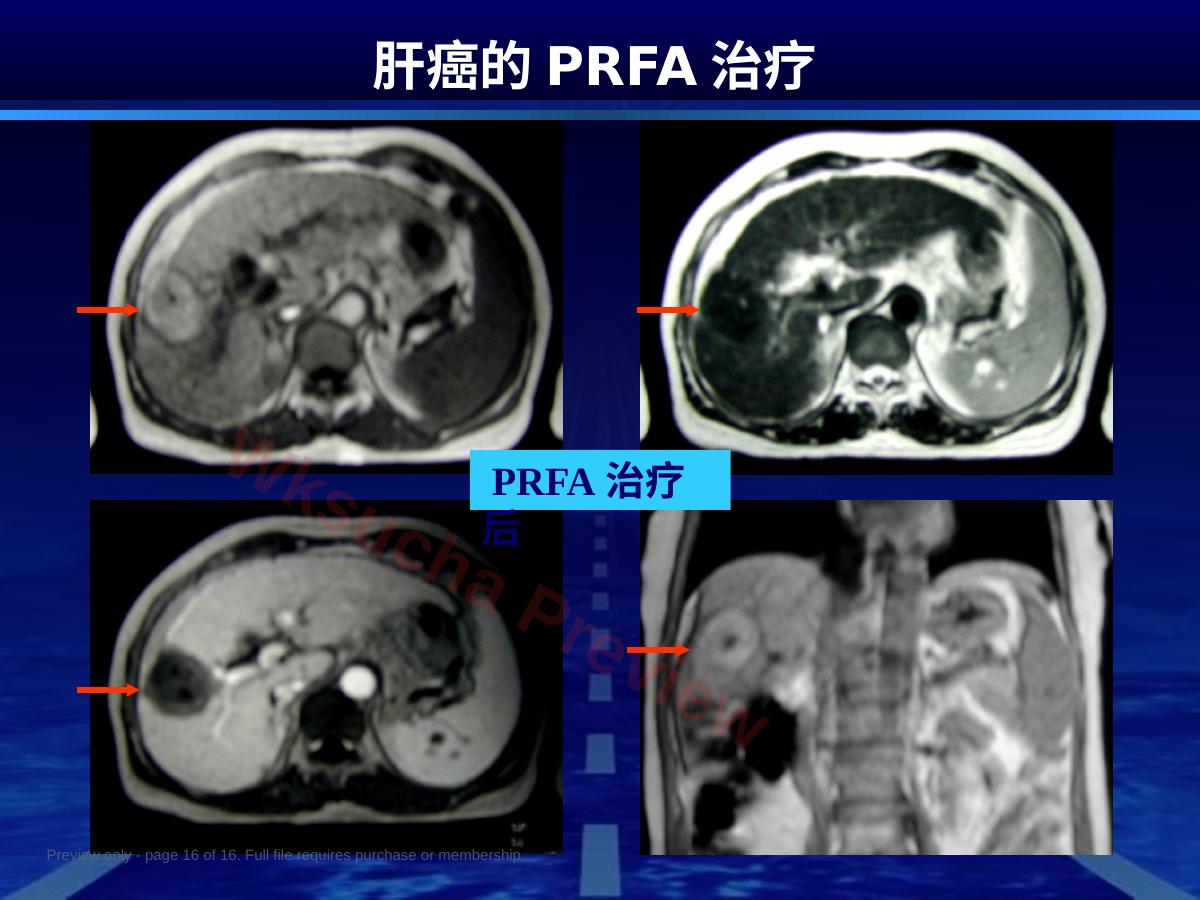 预览第 16 页