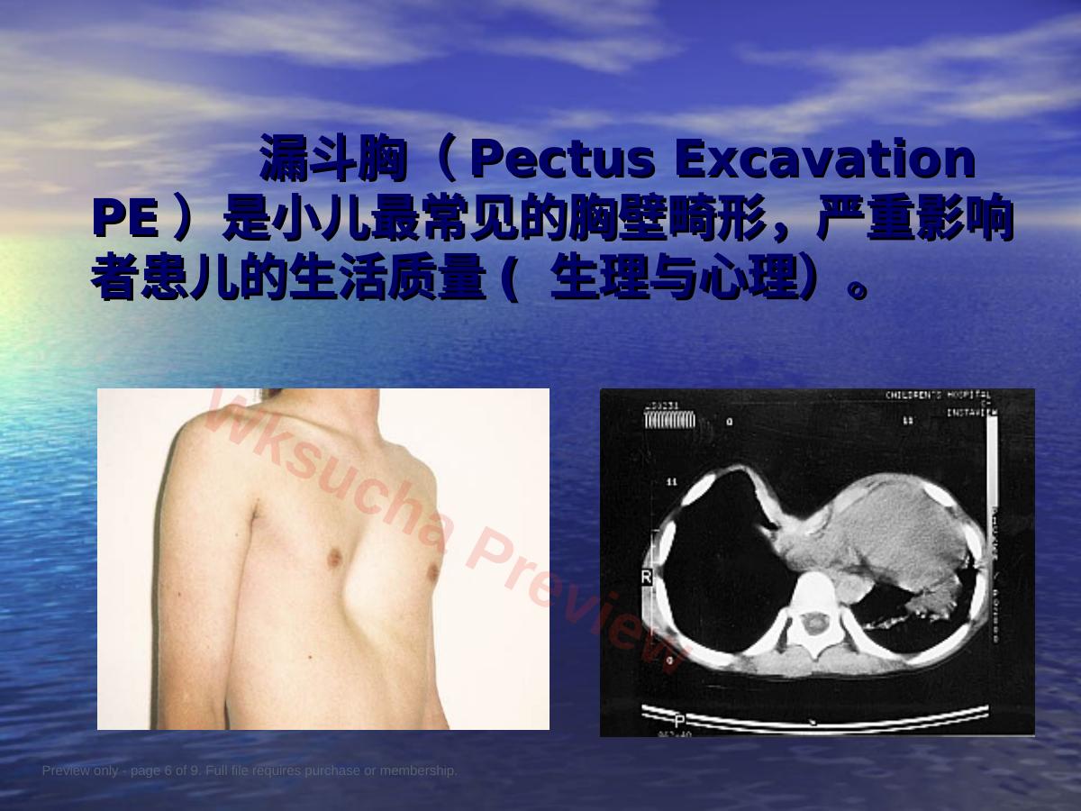 预览第 6 页