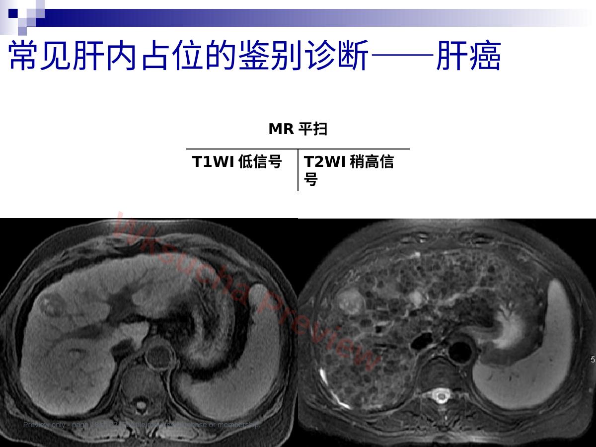 预览第 18 页