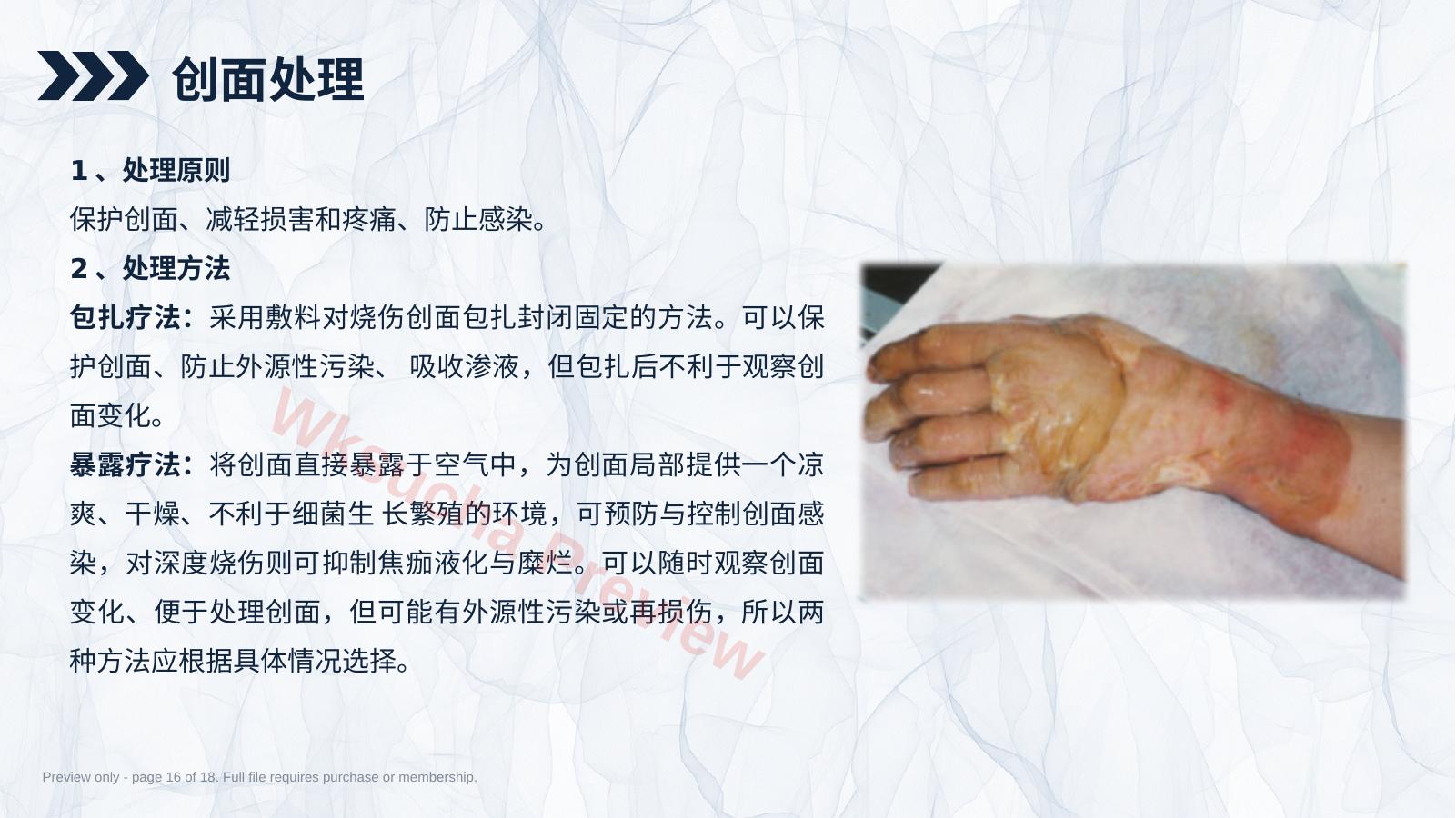 预览第 16 页