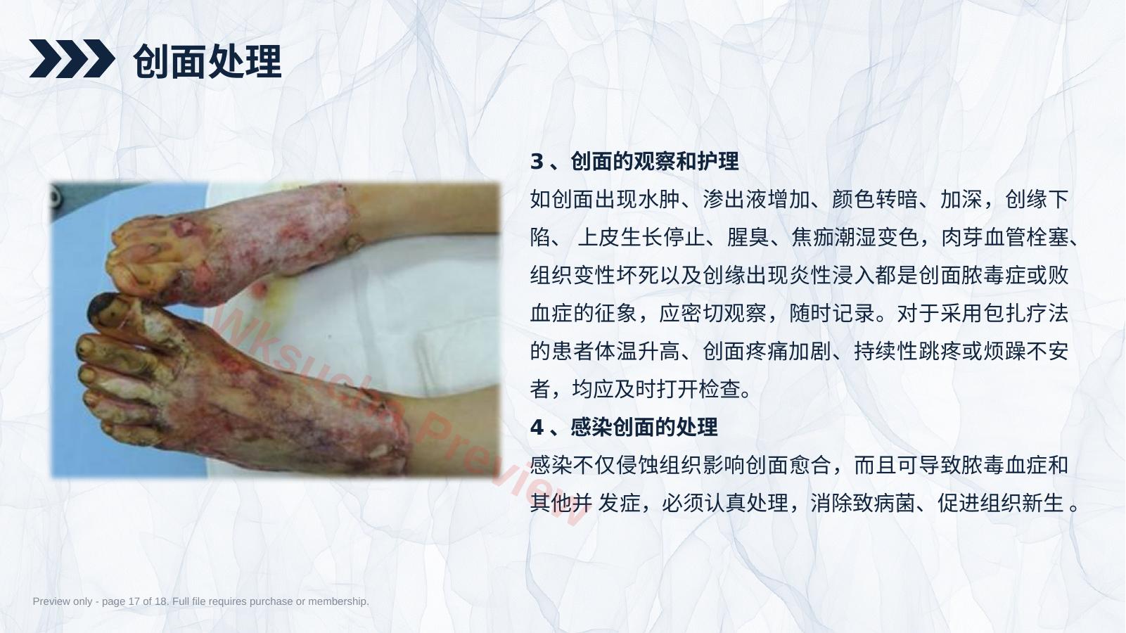 预览第 17 页