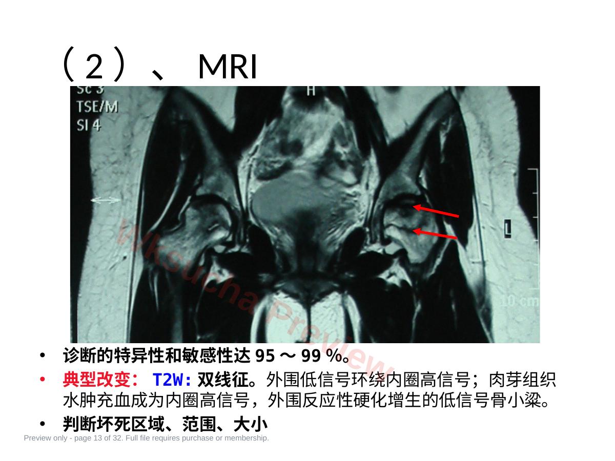 预览第 13 页