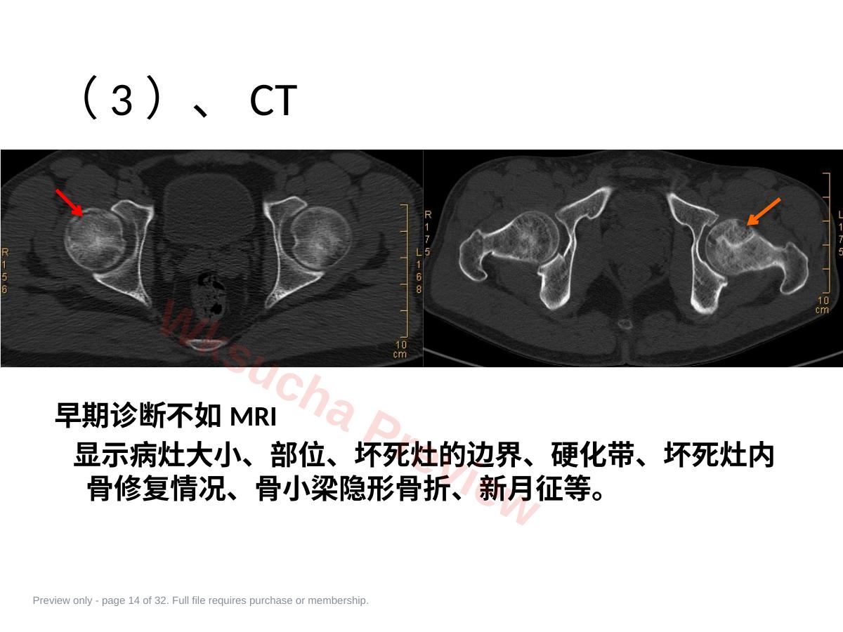 预览第 14 页