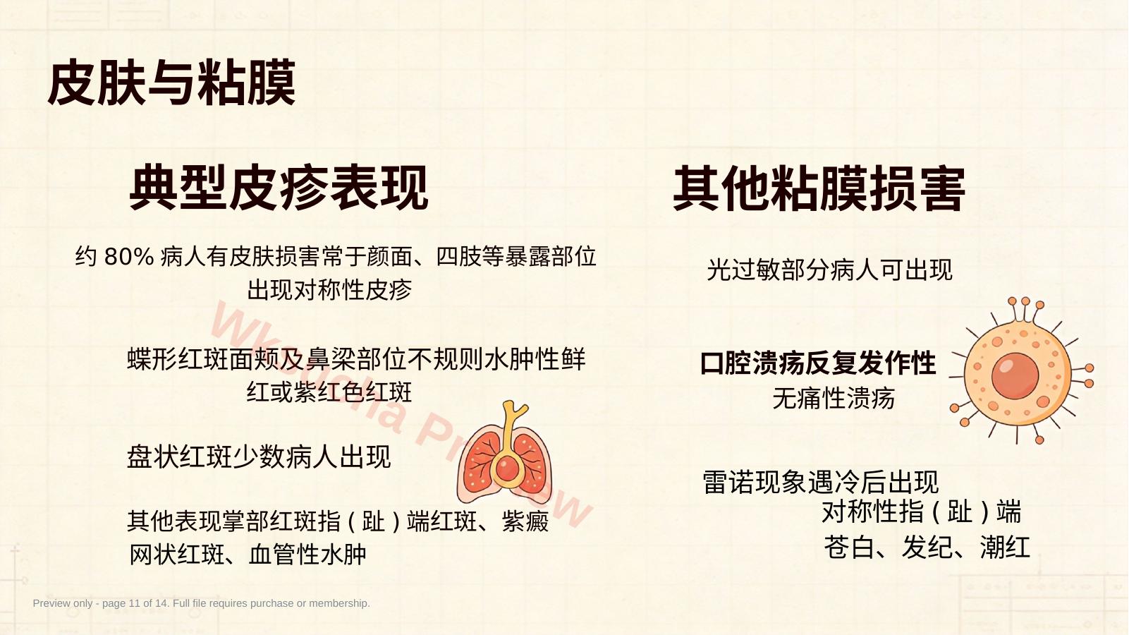 预览第 11 页