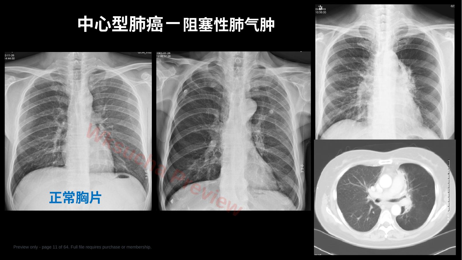 预览第 11 页