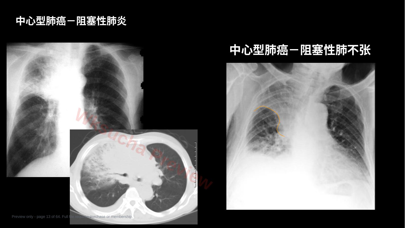 预览第 13 页