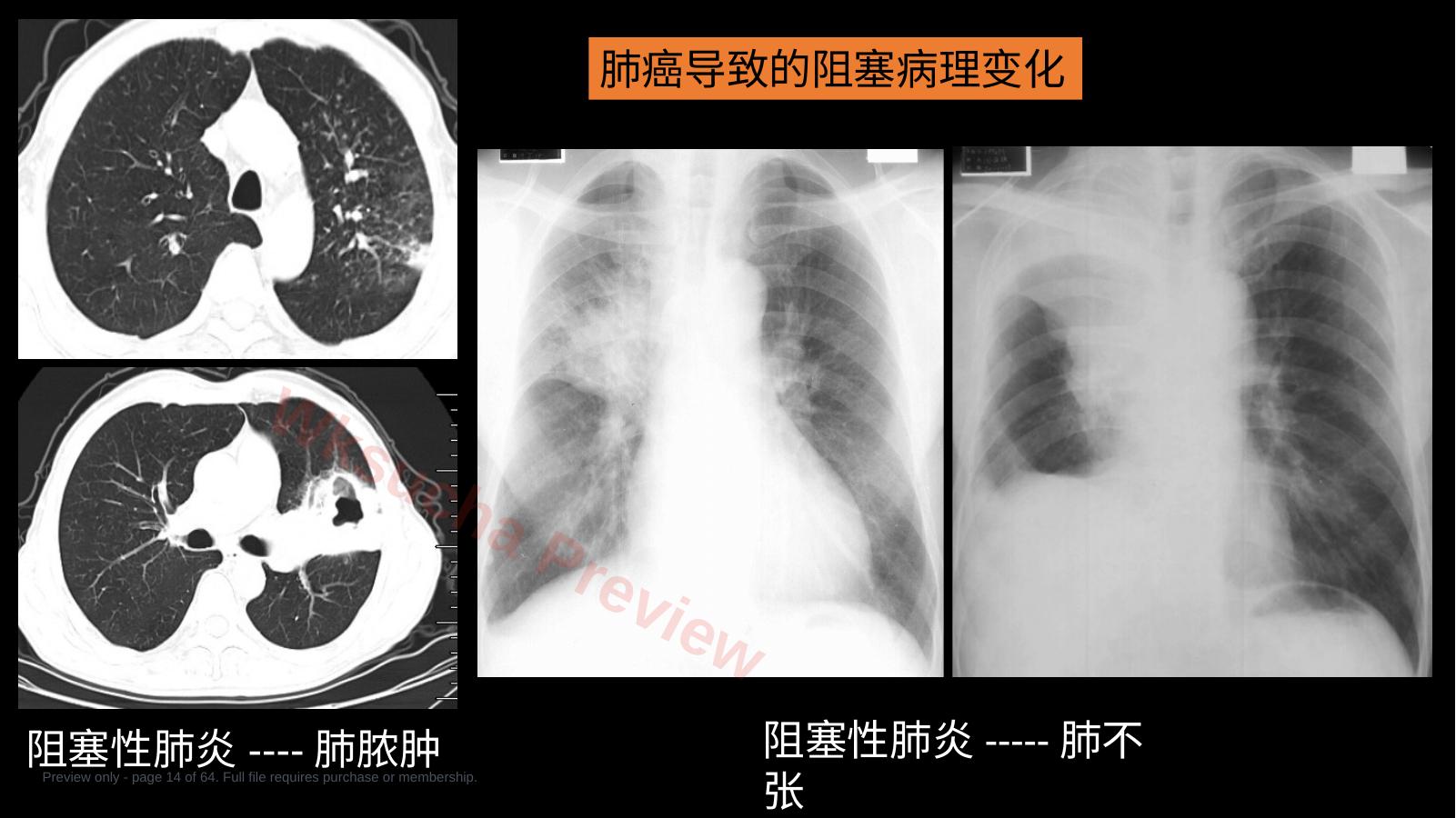 预览第 14 页