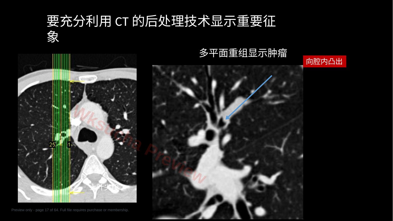 预览第 17 页
