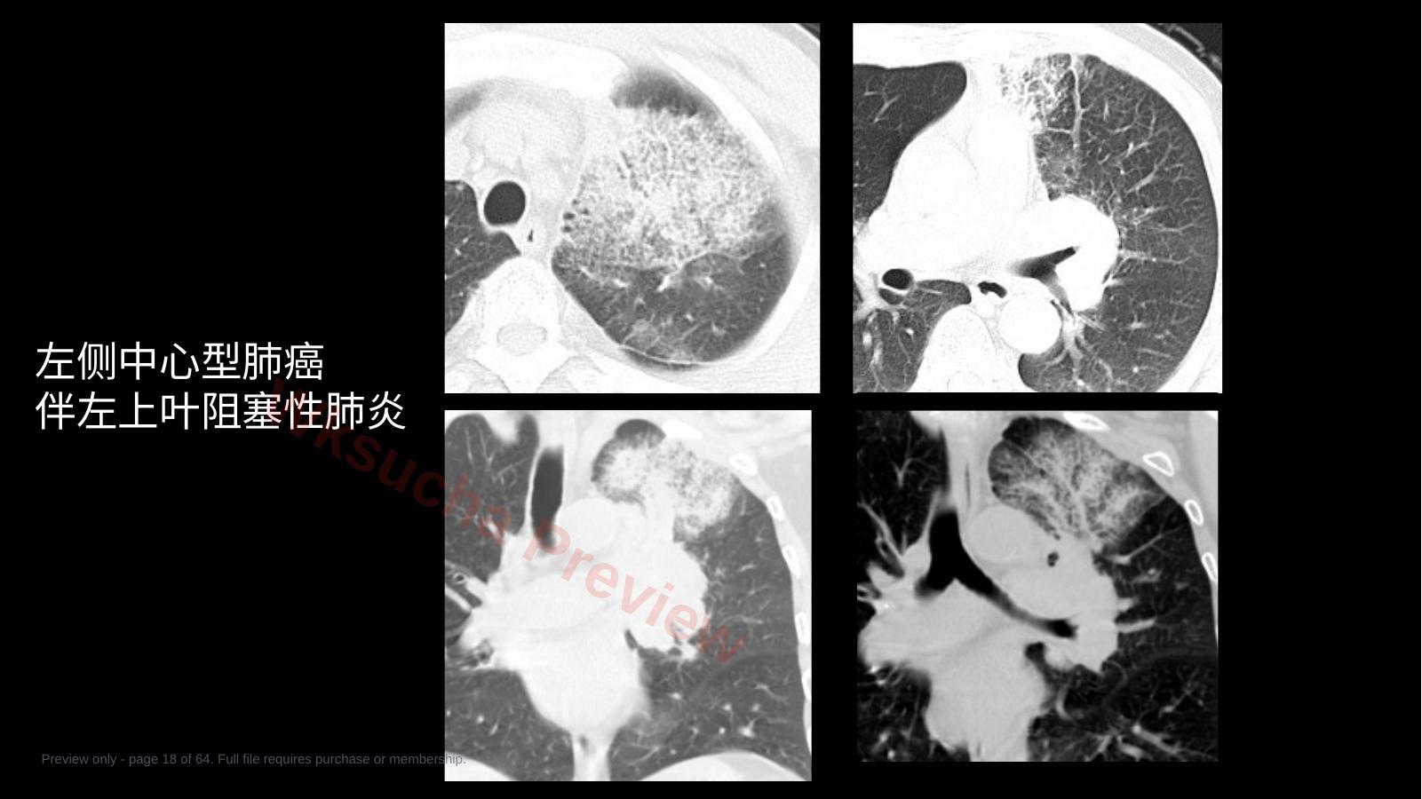 预览第 18 页