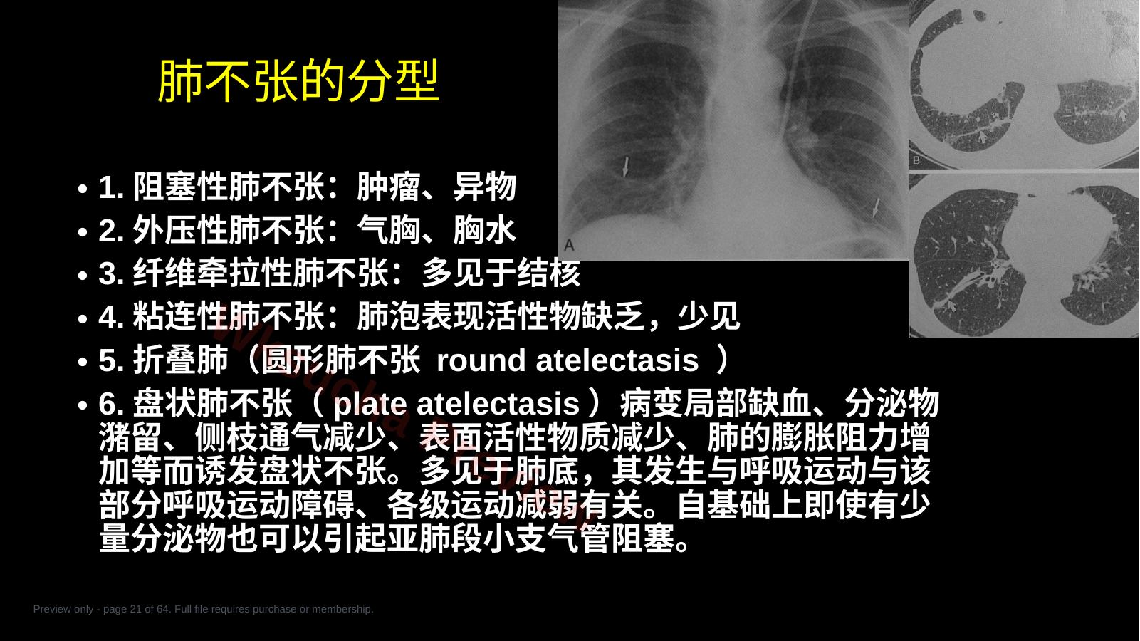 预览第 21 页
