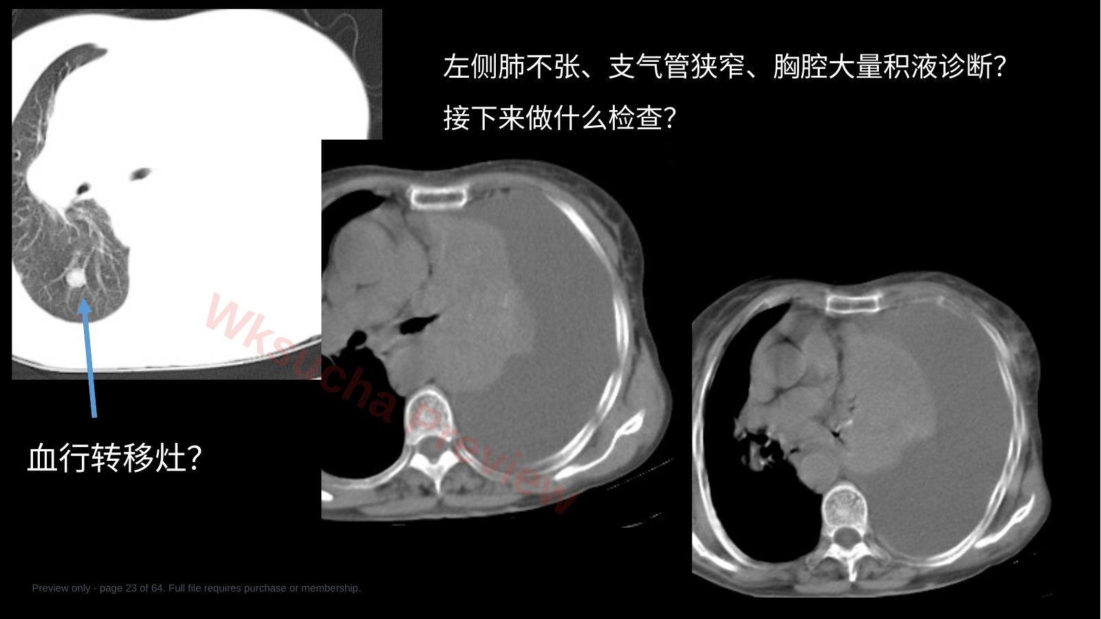 预览第 23 页