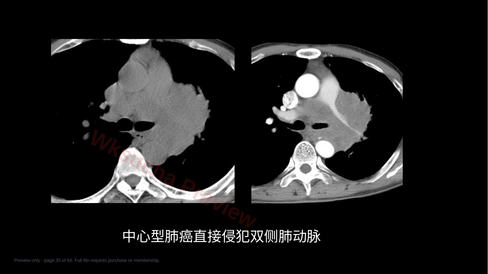 预览第 35 页
