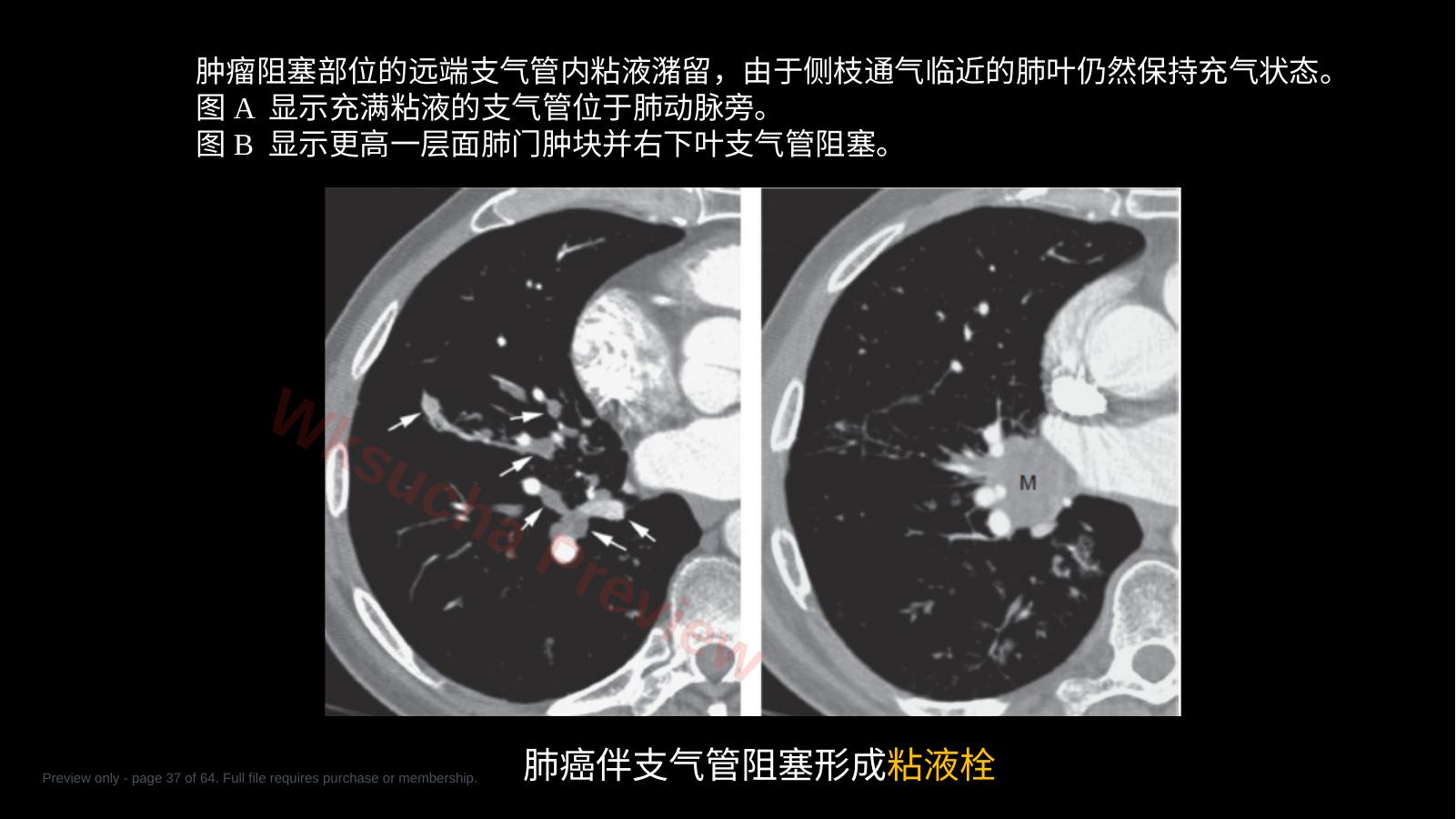 预览第 37 页