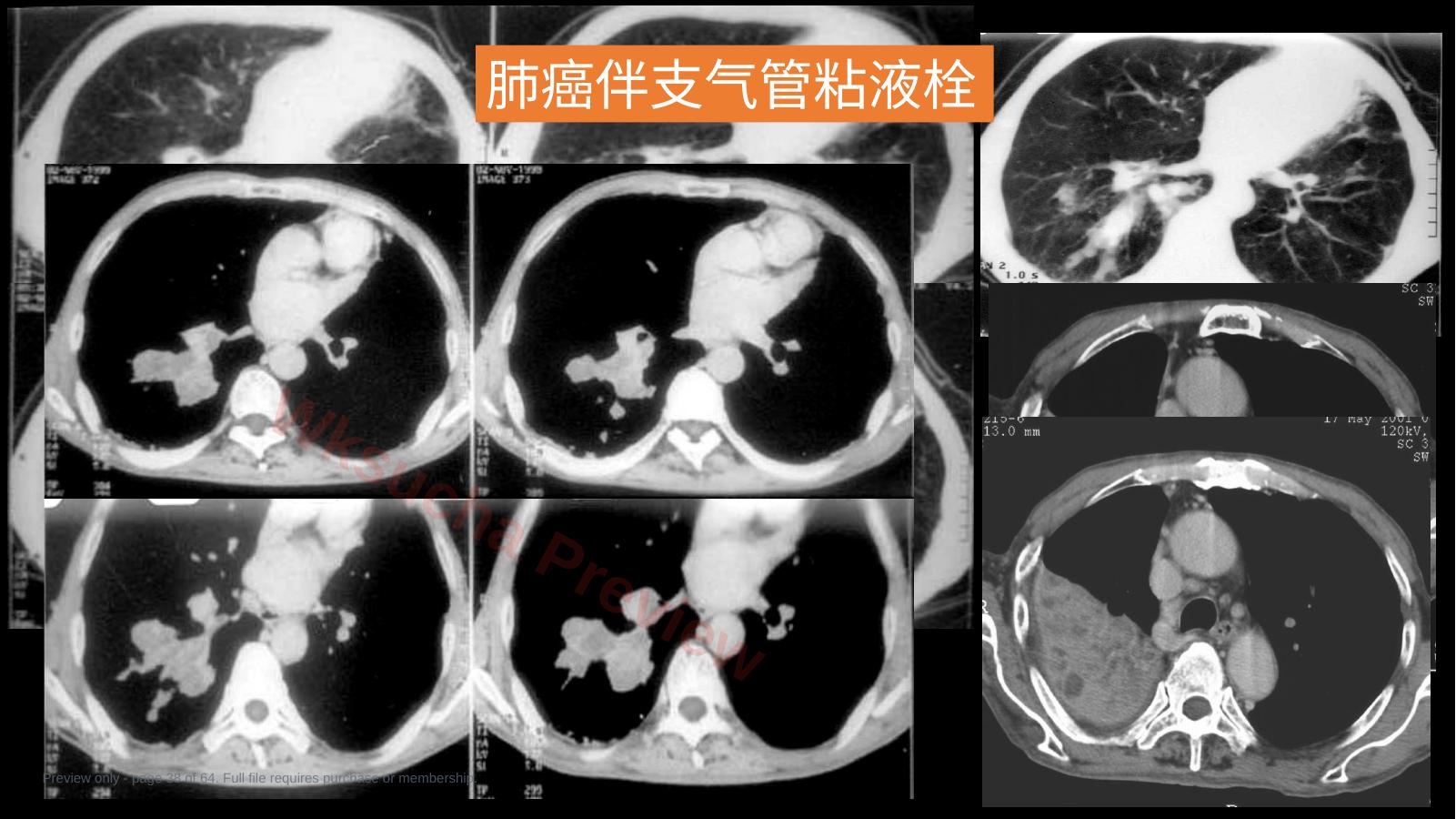 预览第 38 页