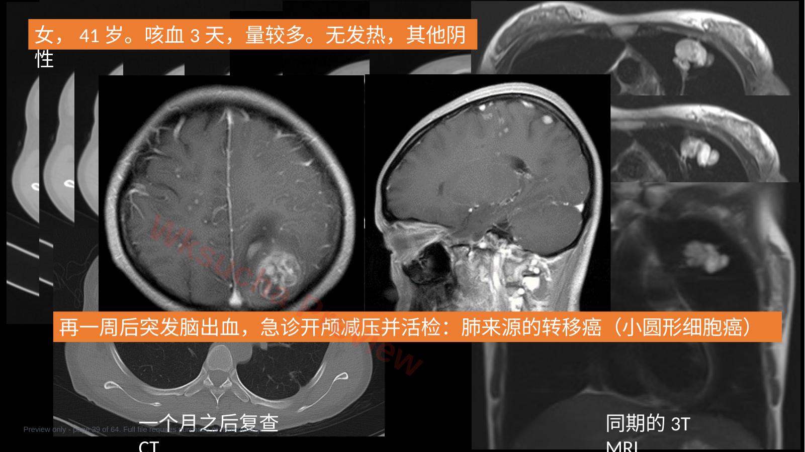 预览第 39 页