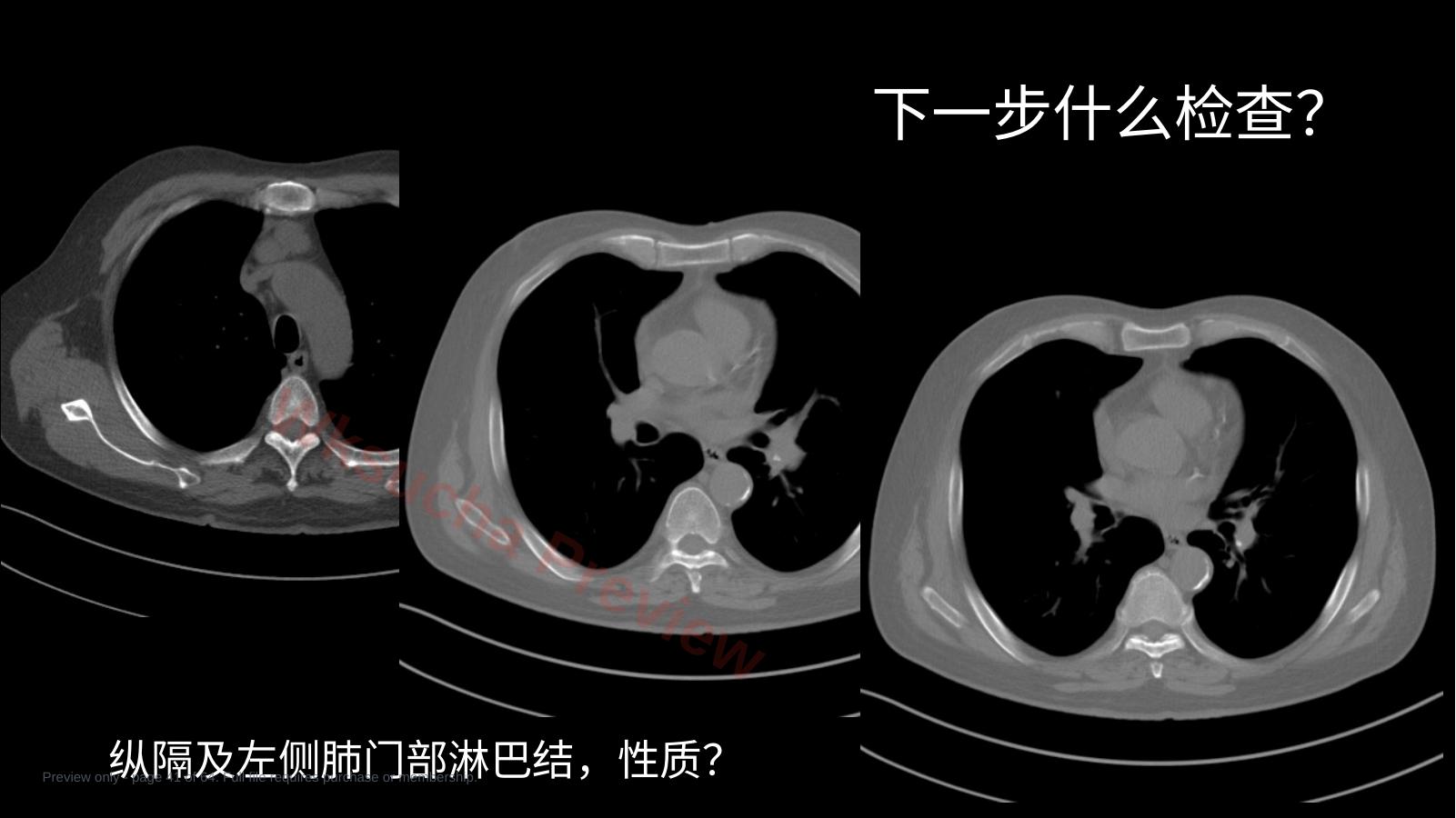 预览第 41 页