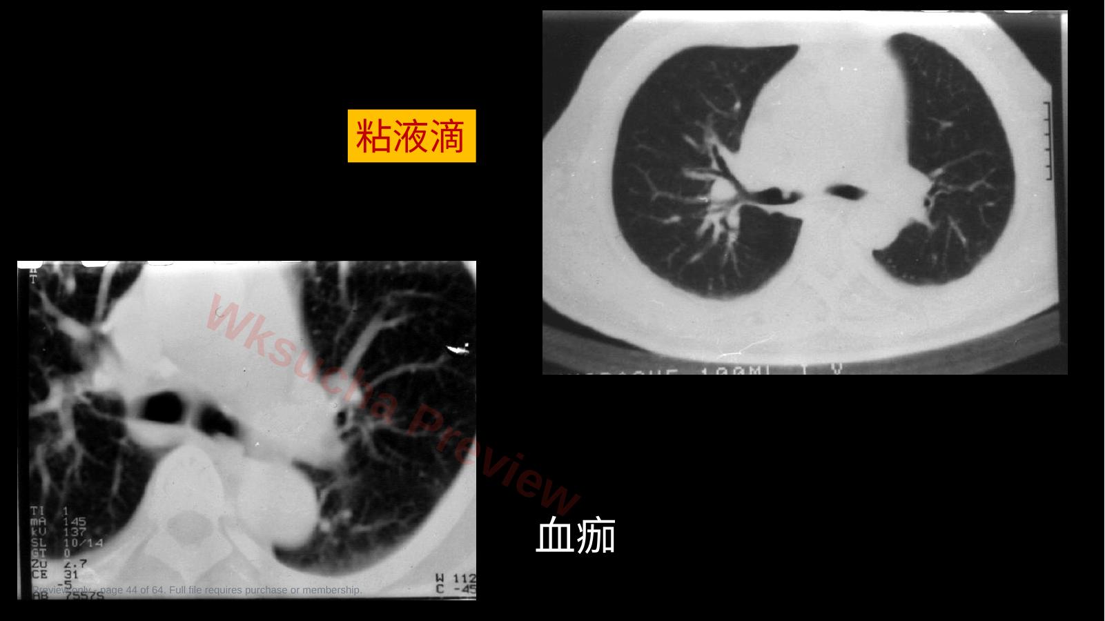 预览第 44 页