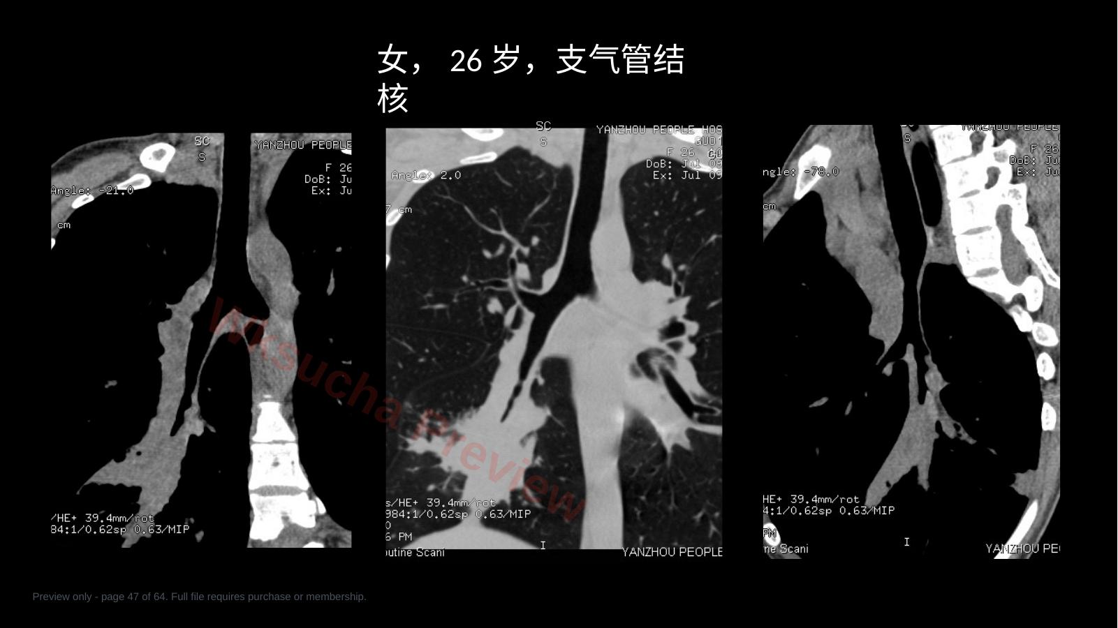 预览第 47 页