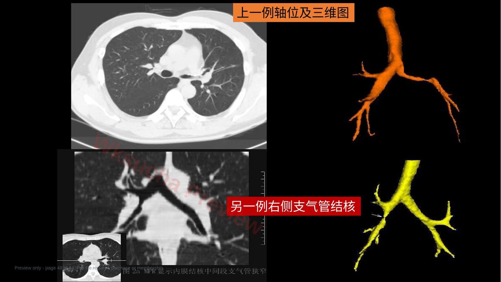 预览第 48 页