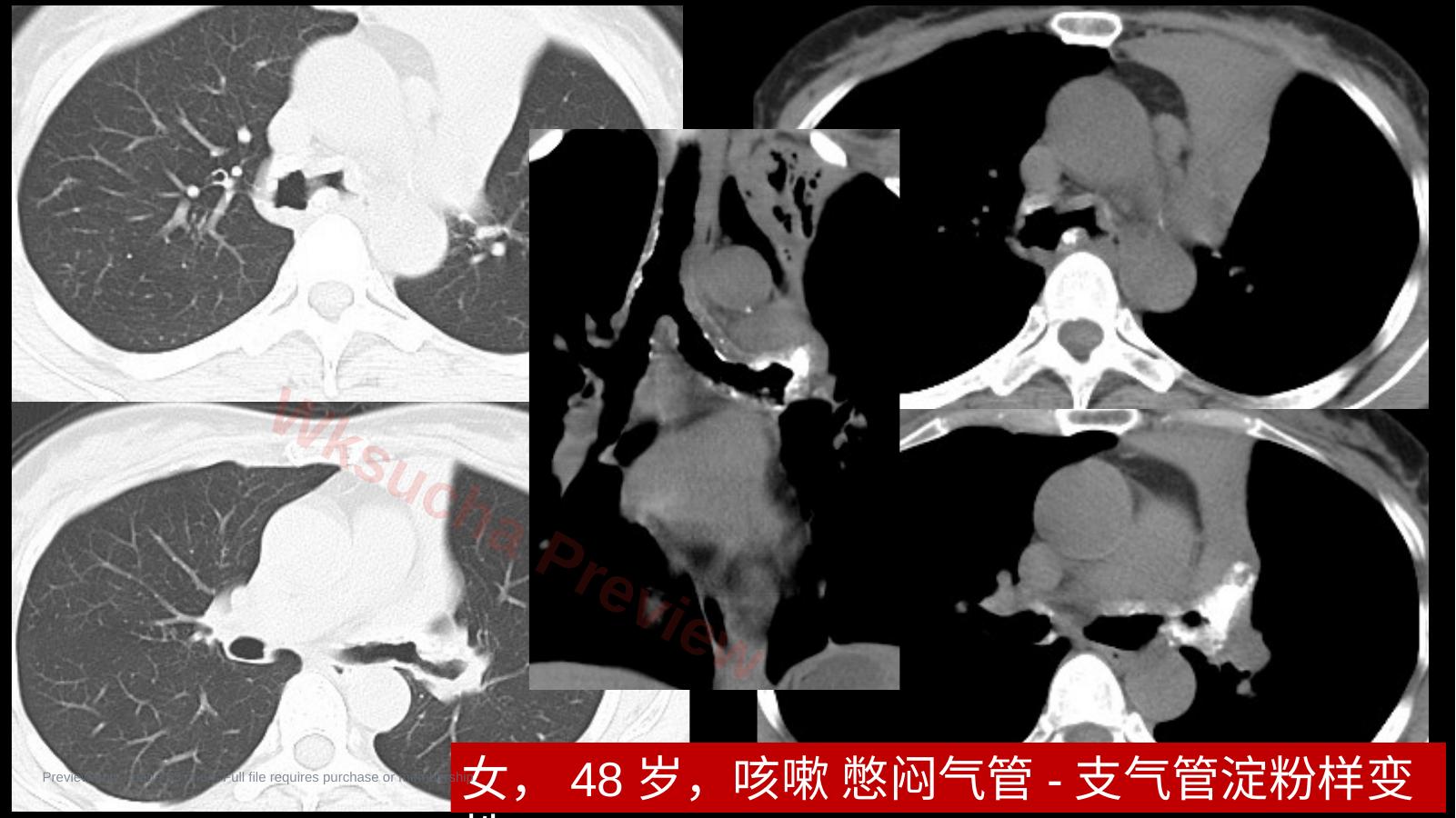 预览第 53 页