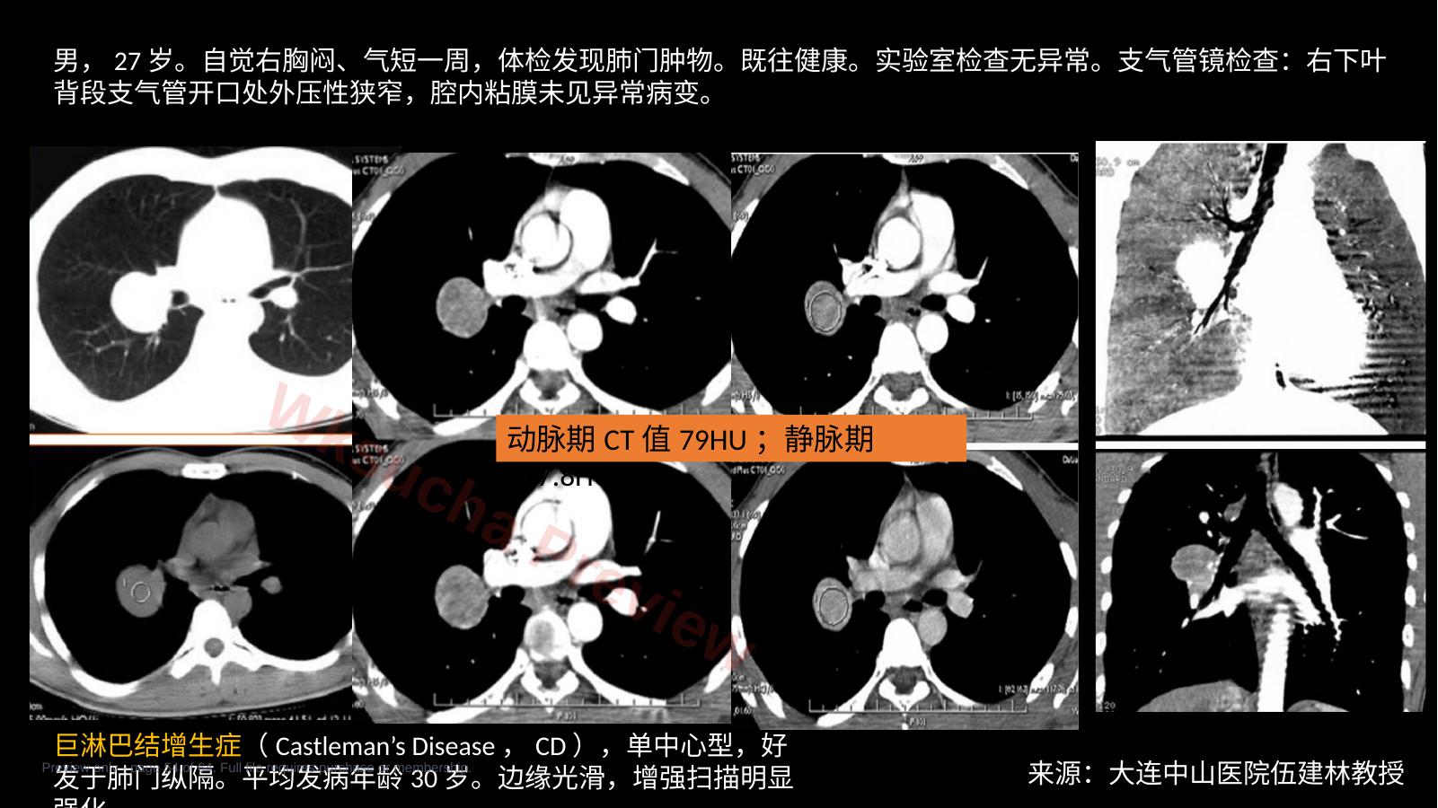 预览第 54 页