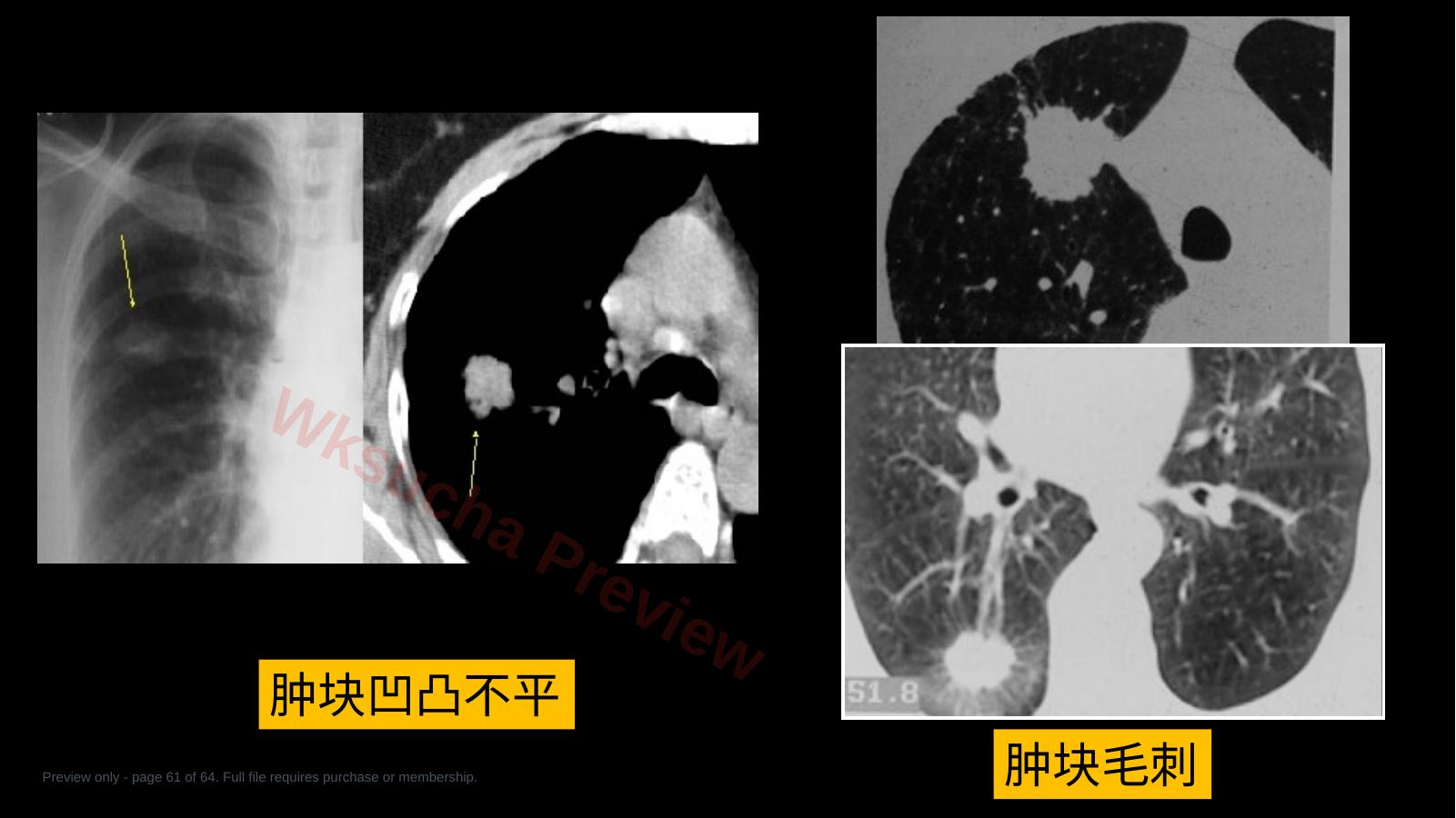 预览第 61 页